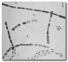 Bacillus anthracis